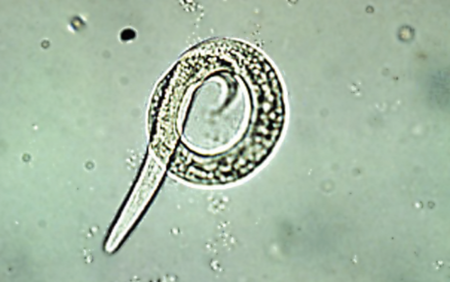 Larve de ver pulmonaire  Dictyocaulus viviparus au stade L1  ©École vétérinaire de l'université de Pennsylvannie