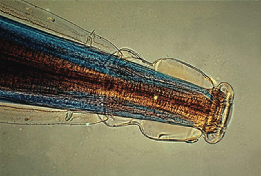 Tête d’Œsophagostomum radiatum ©École vétérinaire de l'Université de Pennsylvanie