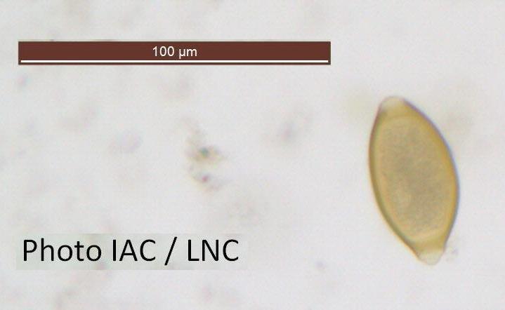 Œuf de Trichuris ©IAC, LNC