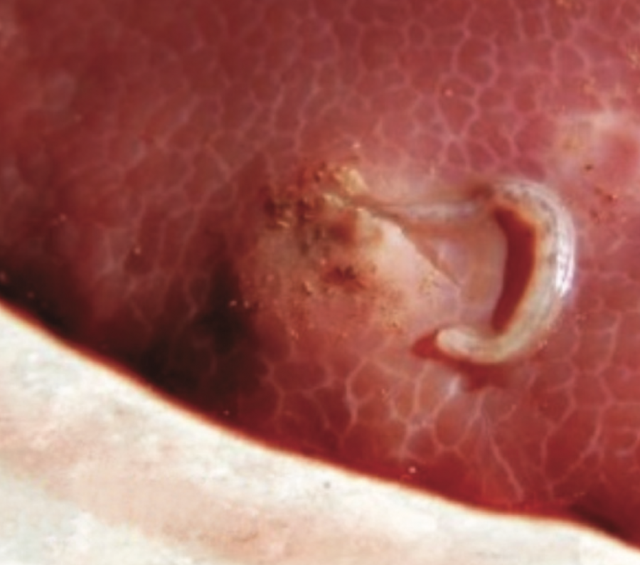 Lésion provoquée sur le foie de l’hôte par Stephanurus dentatus ©IAC