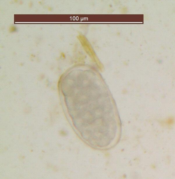 Œuf d'Œsophagostomum radiatum ©IAC, LNC