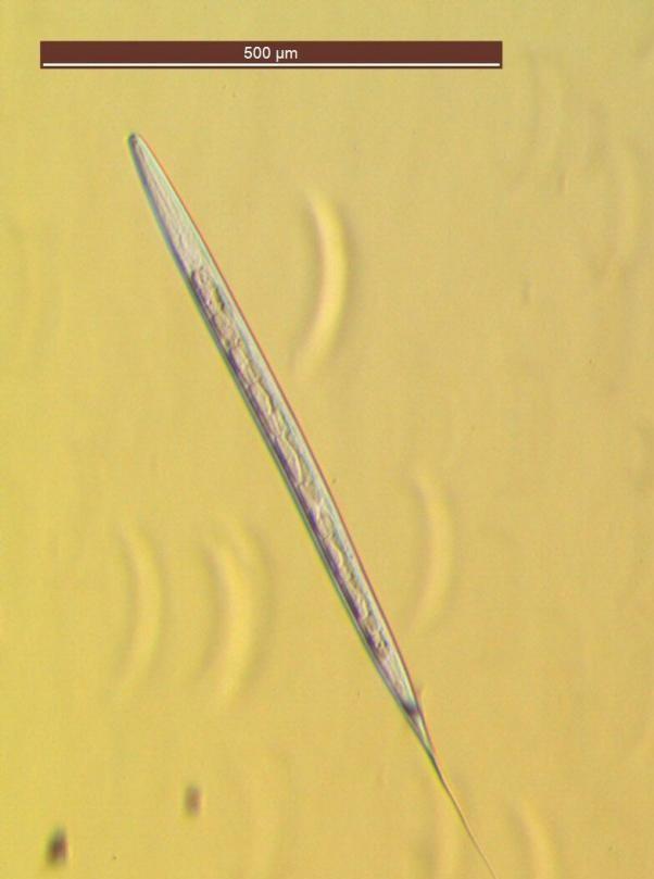 Larve L3 d'Œsophagostomum radiatum ©IAC, LNC